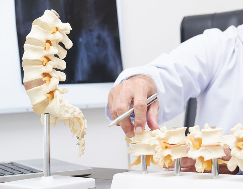 San Antonio Endoscopic Spine Surgery - TX Spine Doctor